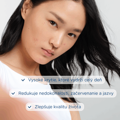 BIODERMA Sébium Kerato+ tónovaný gél-krém na akné s vysokou toleranciou 30 ml – Obrázok 9