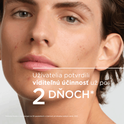 BIODERMA Sébium Kerato+ gél-krém 30 ml – Obrázok 9